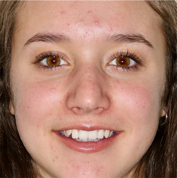 Patient's smile before treatment